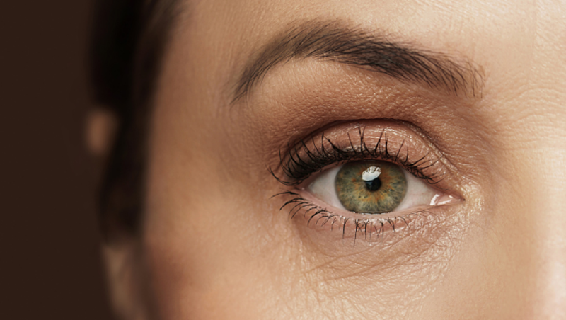 How to Get Rid of Wrinkles Around Eyes
