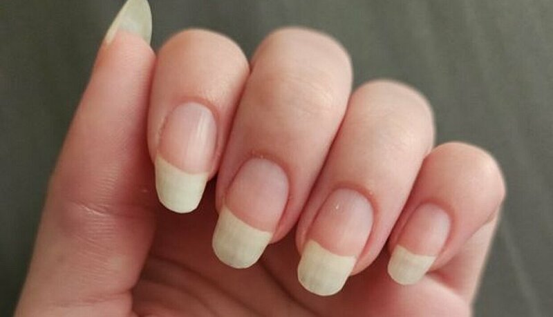  Aging Nails and How to Keep Them Strong