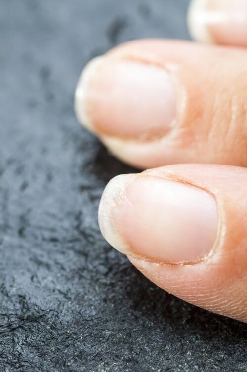  Aging Nails and How to Keep Them Strong