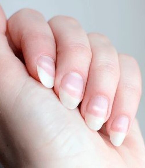 Easy Remedies You Need to Stop Splitting Nails