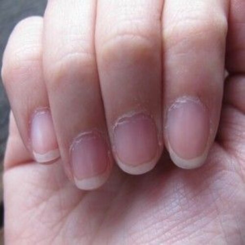 Easy Remedies You Need to Stop Splitting Nails